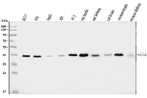 Western blot analysis of TSTA3/GFUS using anti-TSTA3/GFUS antibody (ABIN7825400). (GFUS (AA 44-321) antibody)
