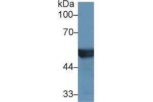 Detection of CYP2D6 in Mouse Liver lysate using Polyclonal Antibody to Cytochrome P450 2D6 (CYP2D6) (CYP2D6 antibody  (AA 236-472))