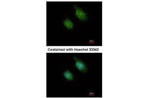 ICC/IF Image Immunofluorescence analysis of methanol-fixed HeLa, using CaMK1D, antibody at 1:500 dilution. (CAMK1D antibody)
