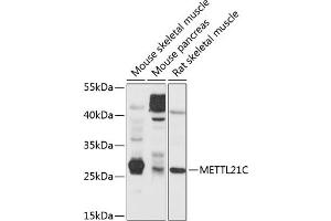 Western blot analysis of extracts of various cell lines, using METTL21C antibody (ABIN6131461, ABIN6143763, ABIN6143764 and ABIN6214649) at 1:1000 dilution. (METTL21C antibody  (AA 1-264))