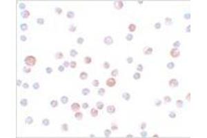 Immunocytochemistry of CaBP7 in HeLa cells with CaBP7 antibody at 4 μg/ml. (CABP7 antibody  (N-Term))