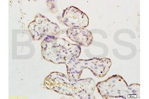 Formalin-fixed and paraffin embedded human placenta labeled with Rabbit Anti ERK1/MAPK3 Polyclonal Antibody, Unconjugated (ABIN736476) at 1:200 followed by conjugation to the secondary antibody and DAB staining (ERK1 antibody  (AA 101-200))