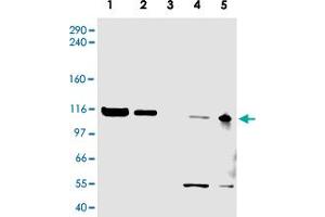 Western blot using ATAD5 polyclonal antibody  shows detection of a band ~120 KDa corresponding to human ATAD5 (arrowhead) in various cell lysates. (ATAD5 antibody  (AA 63-76))