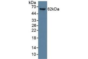 Detection of CK9 in Human Lung Tissue using Monoclonal Antibody to Cytokeratin 9 (CK9) (KRT9 antibody  (AA 315-456))