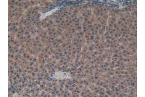 IHC-P analysis of Rat Liver Tissue, with DAB staining. (FGFRL1 antibody  (AA 164-368))