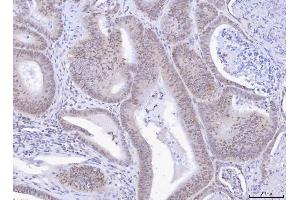 IHC analysis of TOX using anti-TOX antibody (ABIN7599443). (TOX antibody  (AA 1-495))