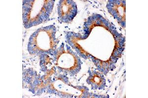 Immunohistochemistry (IHC) image for anti-Insulin Receptor Substrate 1 (IRS1) (AA 1041-1242) antibody (ABIN3043251)