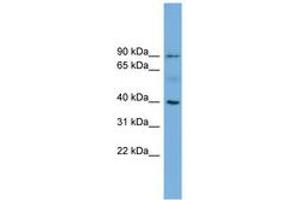 Image no. 1 for anti-Hemochromatosis (HFE) (AA 35-84) antibody (ABIN6744769)