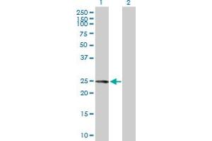 Western Blot analysis of FKBP7 expression in transfected 293T cell line by FKBP7 MaxPab polyclonal antibody. (FKBP7 antibody  (AA 1-222))