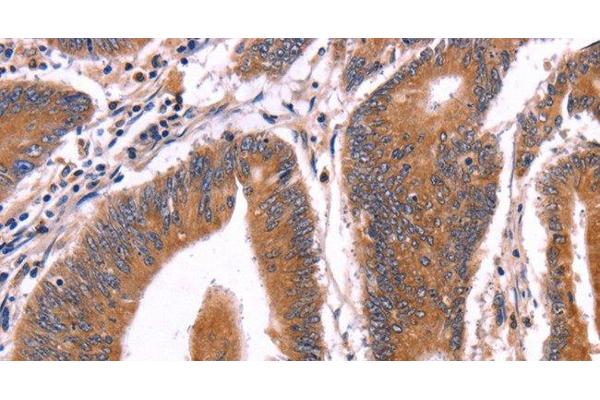 CRISP3 antibody