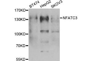 Western blot analysis of extracts of various cell lines, using NFATC3 antibody (ABIN5974017) at 1/1000 dilution. (NFATC3 antibody)