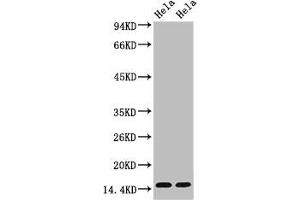 Western blot analysis of Hela, diluted at 1) 1:1000 2) 1:5000 (Tri-Methyl-Histone H3(K36) (H3K36me3) antibody)