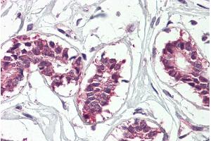 ABIN571172 (3. (IGF2BP1 antibody  (Internal Region))