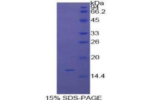 SDS-PAGE (SDS) image for Inhibin, alpha (INHA) (AA 227-360) protein (His tag) (ABIN1079910) (Inhibin alpha Protein (AA 227-360) (His tag))