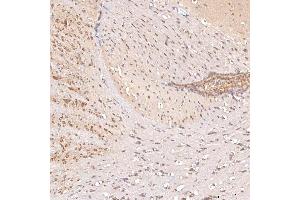 IHC analysis of SGCE using anti-SGCE antibody (ABIN7601544). (SGCE antibody  (AA 38-407))