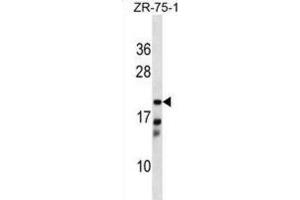 Western Blotting (WB) image for anti-Carbonyl Reductase 4 (CBR4) antibody (ABIN5019097)