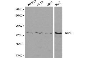 Western blot analysis of extracts of various cell lines, using IKBKB antibody (ABIN5971113) at 1/500 dilution. (IKBKB antibody)