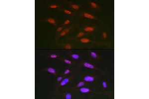 Immunofluorescence analysis of U2OS cells using Phospho-c-Jun-T91 Rabbit pAb (ABIN7268058) at dilution of 1:50 (40x lens). (C-JUN antibody  (pThr91))