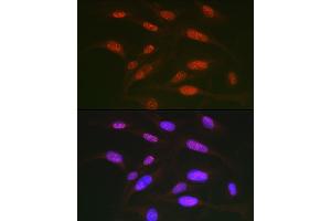 Immunofluorescence analysis of U2OS cells using Phospho-c-Jun-T91 Rabbit pAb (ABIN7268058) at dilution of 1:50 (40x lens).