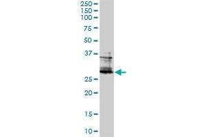 FOSL2 monoclonal antibody (M01), clone 2B4-1C2. (FOSL2 antibody  (AA 1-122))