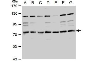 WB Image TACC2 antibody detects TACC2 protein by western blot analysis. (TACC2 antibody  (N-Term))
