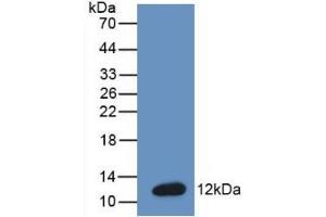 Detection of Recombinant BNP, Mouse using Monoclonal Antibody to Brain Natriuretic Peptide (BNP) (BNP antibody  (AA 77-121))