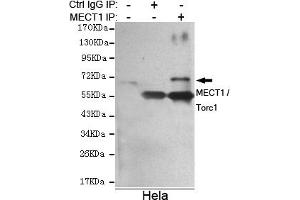 Immunoprecipitation analysis of Hela cell lysate using MECT1 / Torc1 mouse mAb. (CRTC1 antibody)