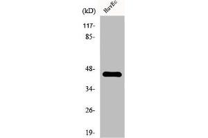 Western Blot analysis of Jurkat cells using FAM80A Polyclonal Antibody (RIMKLA antibody  (Internal Region))