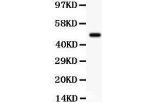 Western Blotting (WB) image for anti-serum/glucocorticoid Regulated Kinase 1 (SGK1) (AA 28-55), (N-Term) antibody (ABIN3043433)