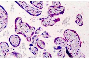 Human Placenta: Formalin-Fixed, Paraffin-Embedded (FFPE) (Bcl-2 antibody  (FITC))