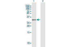 Western Blotting (WB) image for anti-Tumor Necrosis Factor Receptor Superfamily, Member 13C (TNFRSF13C) (AA 1-184) antibody (ABIN2565953)