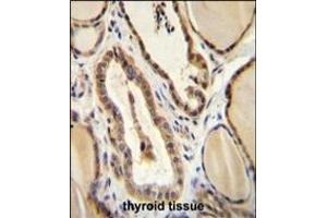 Immunohistochemistry (Paraffin-embedded Sections) (IHC (p)) image for anti-Guanylate Cyclase 2D, Membrane (Retina-Specific) (GUCY2D) (AA 540-570) antibody (ABIN655516)