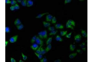 Immunofluorescence staining of Hela cells with ABIN7144538 at 1:133, counter-stained with DAPI. (ALOX15 antibody  (AA 1-225))
