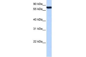 ZNF33A antibody used at 2 ug/ml to detect target protein. (ZNF33A antibody  (Middle Region))