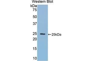 Detection of Recombinant RALBP1, Mouse using Polyclonal Antibody to RalA Binding Protein 1 (RALBP1) (RALBP1 antibody  (AA 192-380))