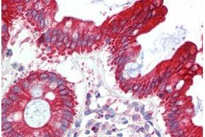 Human Colon (formalin-fixed, paraffin-embedded) stained with UBE2L3 antibody ABIN462238 followed by biotinylated goat anti-rabbit IgG secondary antibody ABIN481713, alkaline phosphatase-streptavidin and chromogen. (UBE2L3 antibody  (C-Term))