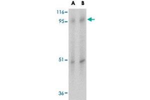 Western blot analysis of SLC39A10 in human spleen tissue lysate with SLC39A10 polyclonal antibody  at (A) 1 and (B) 2 ug/mL .