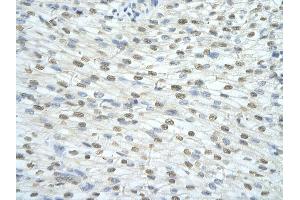 Rabbit Anti-SF3A1 antibody         Paraffin Embedded Tissue:  Human Heart    cell Cellular Data:  cardiac cell    Antibody Concentration:  4.