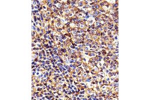 Immunohistochemistry (Paraffin-embedded Sections) (IHC (p)) image for anti-Major Histocompatibility Complex, Class I, B (HLA-B) (AA 75-107), (N-Term) antibody (ABIN1944779)