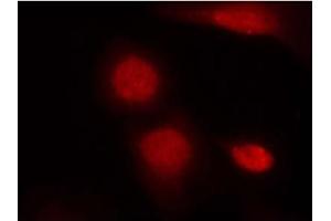 Image no. 1 for anti-Androgen Receptor (AR) (pSer213) antibody (ABIN319225) (Androgen Receptor antibody  (pSer213))