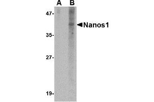Western Blotting (WB) image for anti-Nanos Homolog 1 (NANOS1) (N-Term) antibody (ABIN1031474) (Nanos Homolog 1 antibody  (N-Term))