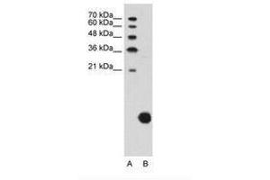 Image no. 1 for anti-Ribosomal Protein S29 (RPS29) (C-Term) antibody (ABIN203394) (RPS29 antibody  (C-Term))
