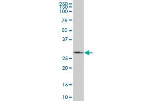 SMNDC1 antibody  (AA 1-238)