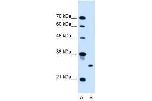 RNF39 antibody used at 2. (RNF39 antibody  (C-Term))