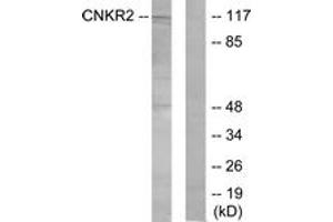 Western blot analysis of extracts from Jurkat cells, using CNKR2 Antibody. (CNKSR2 antibody  (AA 641-690))