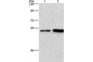Western Blot analysis of Hela and Jurkat cell using SYT4 Polyclonal Antibody at dilution of 1:700