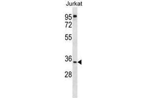 UBXN8 Antibody (N-term) western blot analysis in Jurkat cell line lysates (35 µg/lane). (UBXN8 antibody  (N-Term))