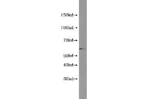 Western Blotting (WB) image for Terminal Complement Complex C5b-9 (C5b-9) ELISA Kit (ABIN1117376) (C5b-9 ELISA Kit)
