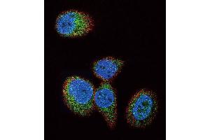 Confocal immunofluorescent analysis of HRAS Antibody (Center) (ABIN392183 and ABIN2841894) with MCF-7 cell followed by Alexa Fluor 488-conjugated goat anti-rabbit lgG (green). (HRAS antibody  (AA 104-128))