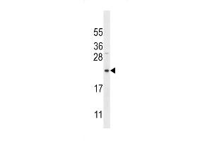 Bit1 Antibody (K95) (ABIN650622 and ABIN2846297) western blot analysis in MDA-M cell line lysates (35 μg/lane). (PTRH2 antibody  (AA 80-110))